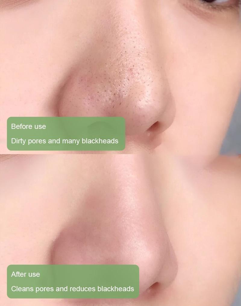 Diystar™ Masque Purifiant et Anti-Bactérien au Thé Vert