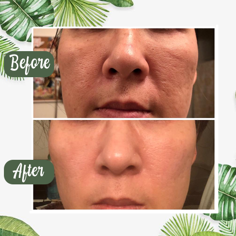 Diystar™ Masque Purifiant et Anti-Bactérien au Thé Vert